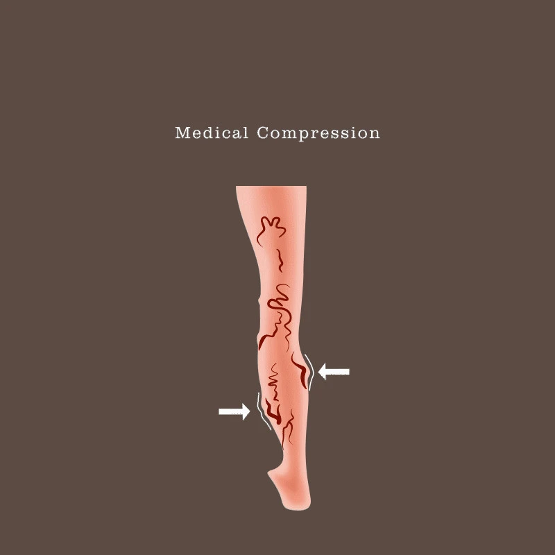 Medical Compression Socks 2