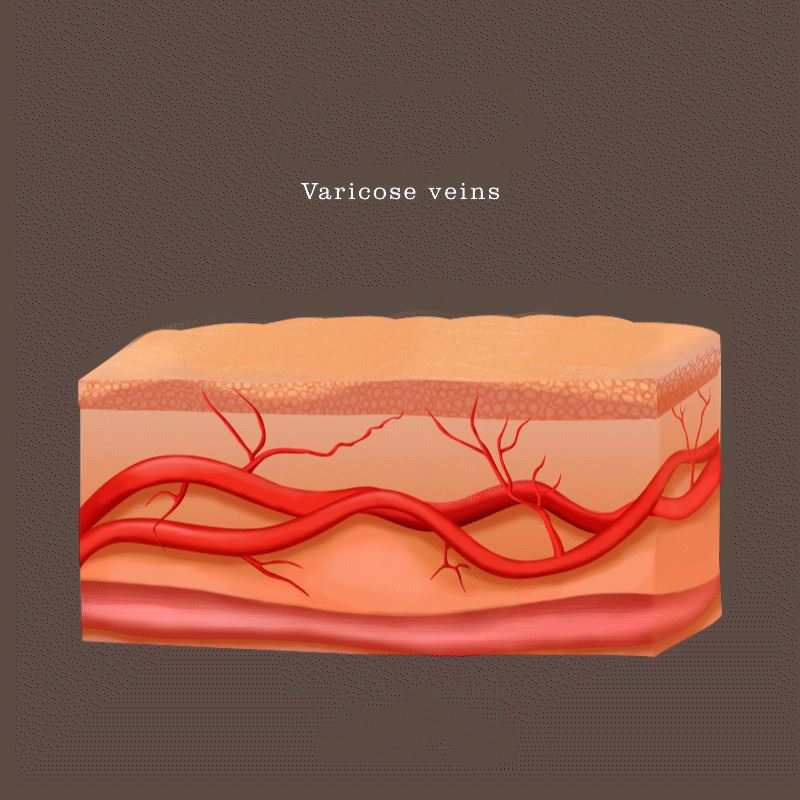 Blood vessel