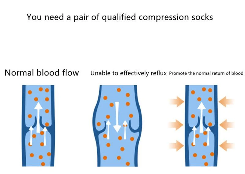 Medical Compression Socks blood