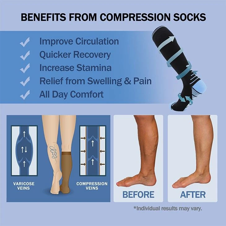 20-30mmHg Knee High Garter With Arch Support For Sports Medical Compression Socks For Women